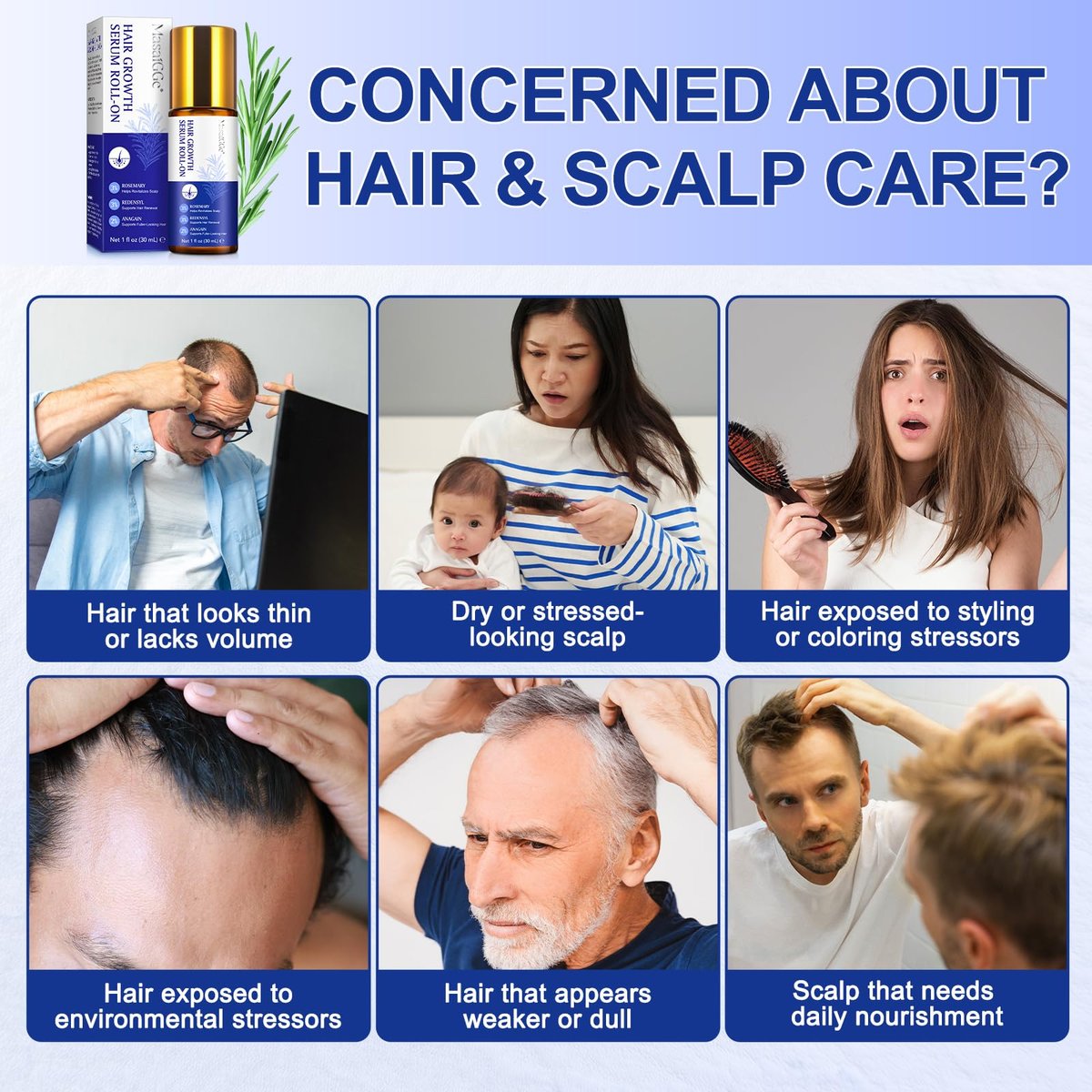 Hair Growth Serum Roll On with 3% Rosemary, 3% Redensyl, 2% Anagain - Nourish Hair Follicles & Support Scalp Health - 30ml - görsel 5