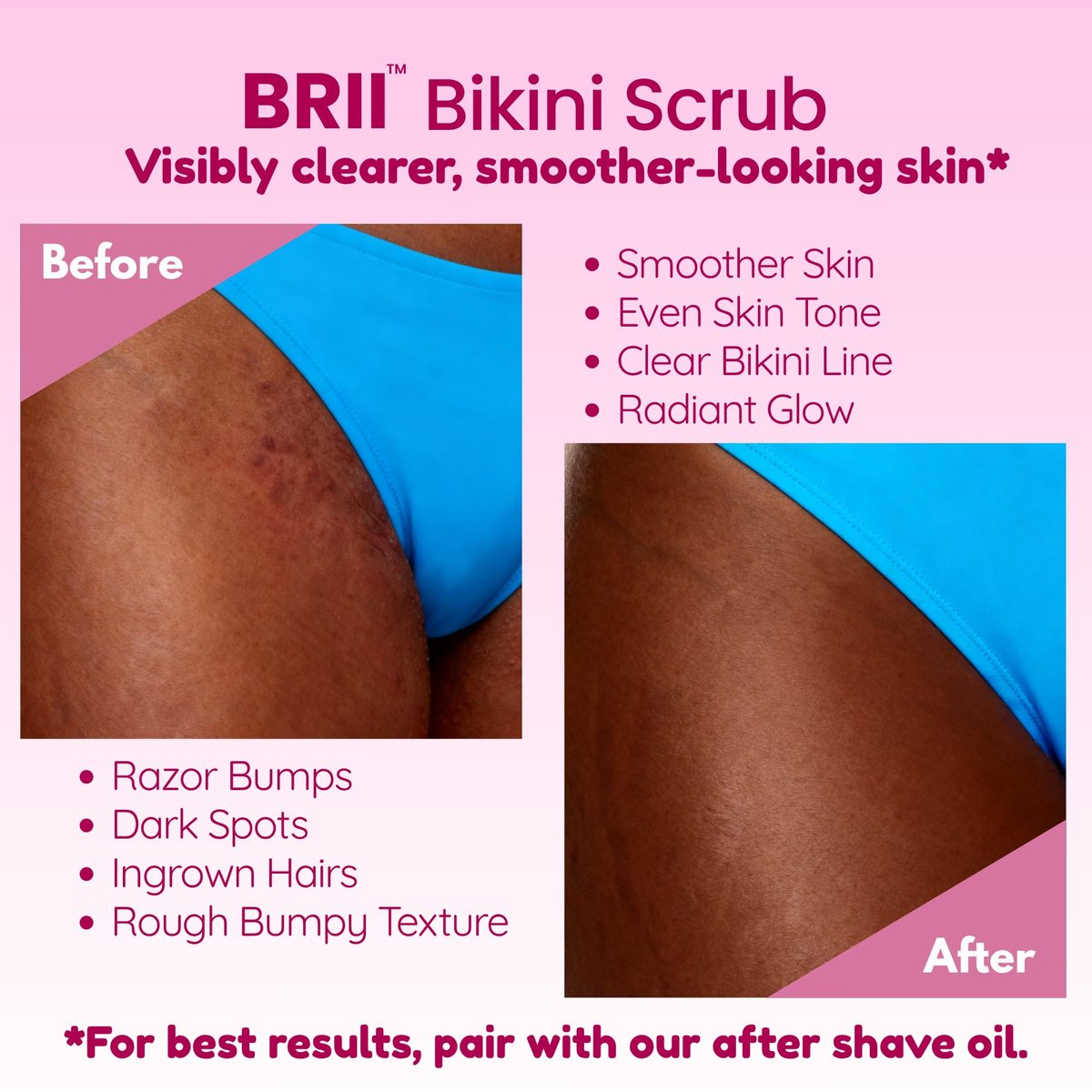 brii Exfoliating Pre Shave + Pre Wax Bikini Area Scrub – Gentle Bikini Line & Intimate Area Scrub for Razor Bumps, Ingrown Hairs & Dark Spots, Strawberry Sugar Pink, 7 oz Avelisse