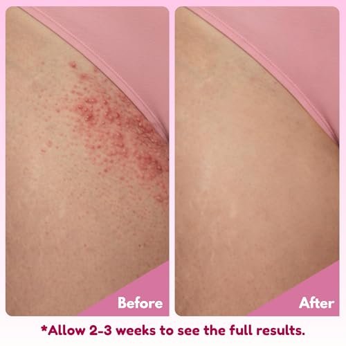 brii Exfoliating Pre Shave + Pre Wax Bikini Area Scrub – Gentle Bikini Line & Intimate Area Scrub for Razor Bumps, Ingrown Hairs & Dark Spots, Strawberry Sugar Pink, 7 oz Avelisse