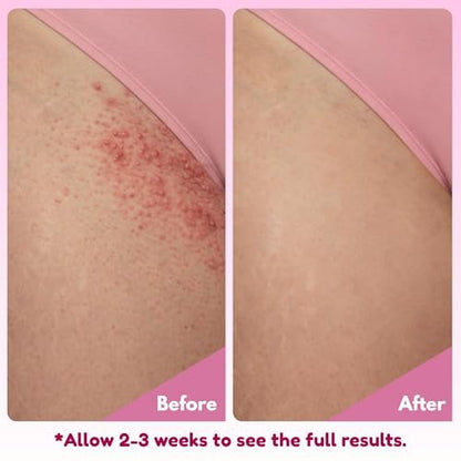 brii Exfoliating Pre Shave + Pre Wax Bikini Area Scrub – Gentle Bikini Line & Intimate Area Scrub for Razor Bumps, Ingrown Hairs & Dark Spots, Strawberry Sugar Pink, 7 oz Avelisse