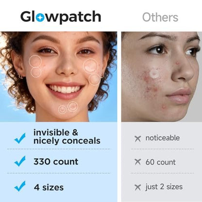 Glowpatch Pimple Patches for Face - 330 Invisible Acne Patches, Daytime Ultra Thin Spot Stickers & Original Hydrocolloid Zit Patch 4 Sizes for Overnight Care