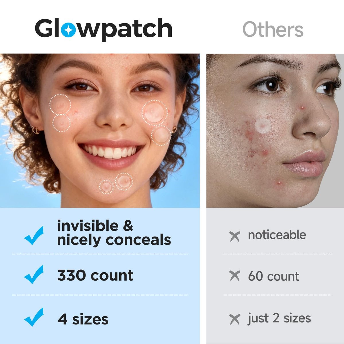 Glowpatch Pimple Patches for Face - 330 Invisible Acne Patches, Daytime Ultra Thin Spot Stickers & Original Hydrocolloid Zit Patch 4 Sizes for Overnight Care - görsel 12