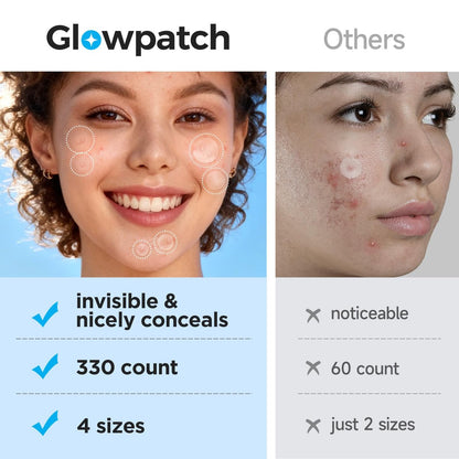 Glowpatch Pimple Patches for Face - 330 Invisible Acne Patches, Daytime Ultra Thin Spot Stickers & Original Hydrocolloid Zit Patch 4 Sizes for Overnight Care