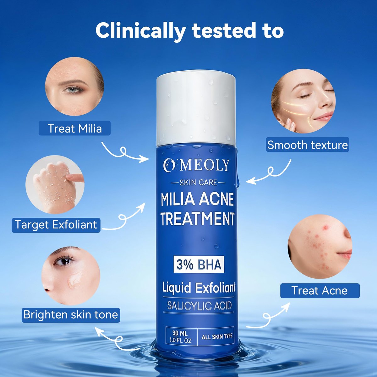 MEOLY Milia Remover Treatment Serum – BHA with Niacinamide for Milia & Acne, Advanced Exfoliant for Men and Women, 30 ML Avelisse