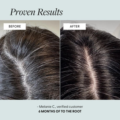 Arey To The Root Hair Serum – Anti-Grey Scalp Serum for Women & Men, Slows Grey Hair Growth & Preserves Pigment, Vegan & Oil-Free (3-Month Supply) Avelisse