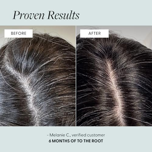 Arey To The Root Hair Serum – Anti-Grey Scalp Serum for Women & Men, Slows Grey Hair Growth & Preserves Pigment, Vegan & Oil-Free (3-Month Supply) Avelisse