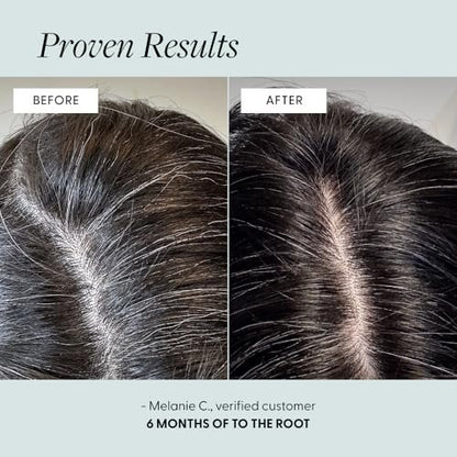 Arey To The Root Hair Serum – Anti-Grey Scalp Serum for Women & Men, Slows Grey Hair Growth & Preserves Pigment, Vegan & Oil-Free (3-Month Supply) Avelisse