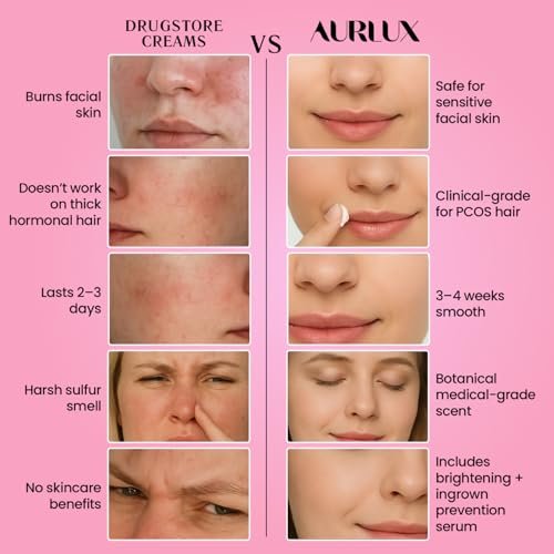 Aurlux Trilogy Kit for PCOS Facial Hair Removal for Women - Clinical Grade Hair Remover for Chin & Upper Lip - 3-Step System Lasts 3-4 Weeks - Soothing Gel with Aloe Vera & Vitamin E Avelisse