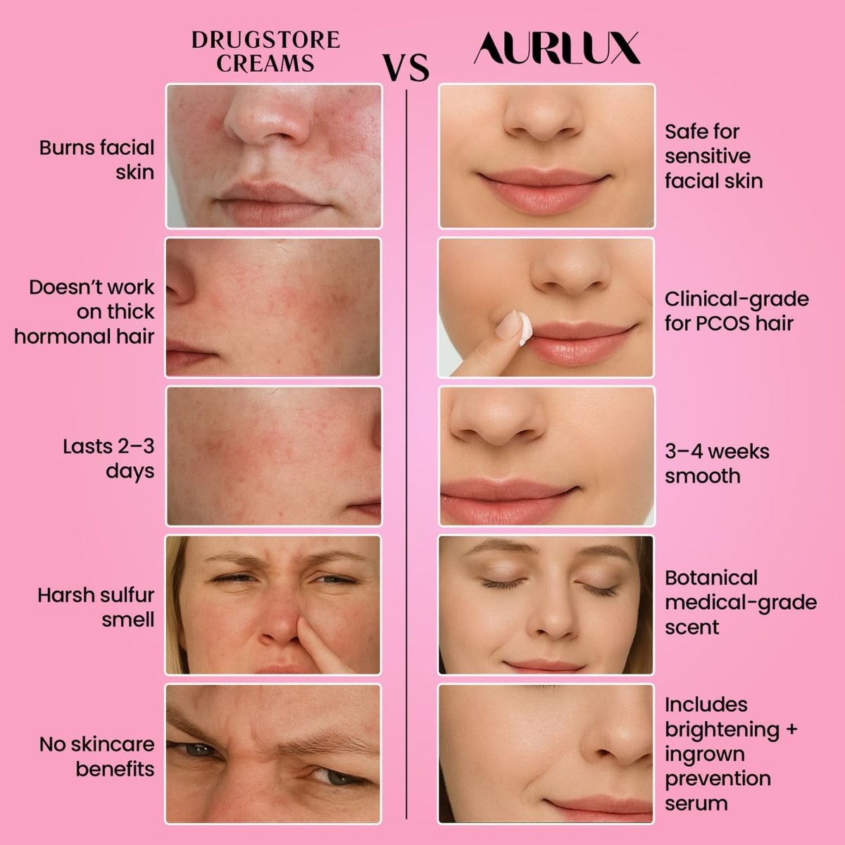 Aurlux Trilogy Kit for PCOS Facial Hair Removal for Women - Clinical Grade Hair Remover for Chin & Upper Lip - 3-Step System Lasts 3-4 Weeks - Soothing Gel with Aloe Vera & Vitamin E Avelisse