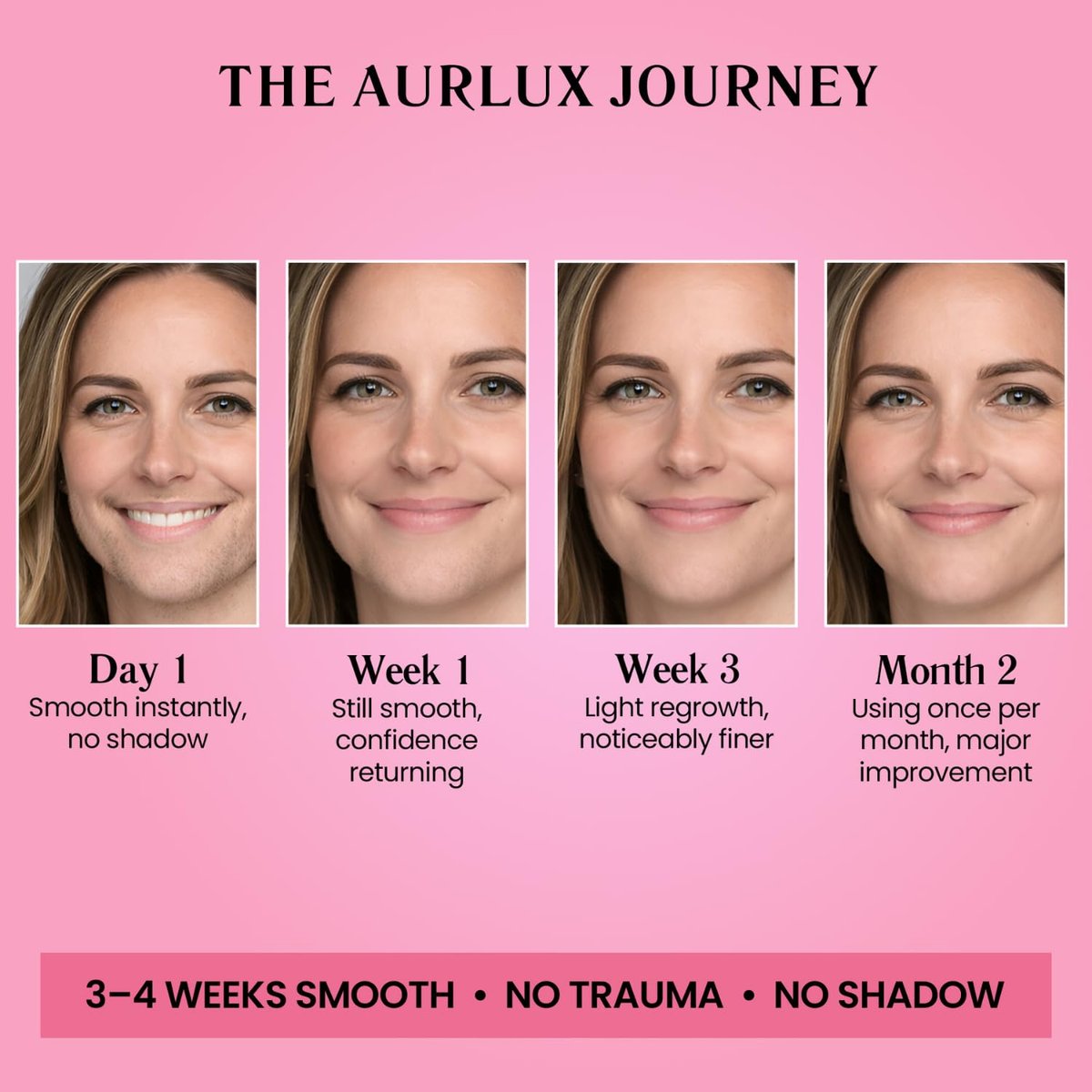 Aurlux Trilogy Kit for PCOS Facial Hair Removal for Women - Clinical Grade Hair Remover for Chin & Upper Lip - 3-Step System Lasts 3-4 Weeks - Soothing Gel with Aloe Vera & Vitamin E Avelisse