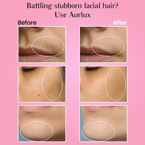 Aurlux Trilogy Kit for PCOS Facial Hair Removal for Women - Clinical Grade Hair Remover for Chin & Upper Lip - 3-Step System Lasts 3-4 Weeks - Soothing Gel with Aloe Vera & Vitamin E Avelisse