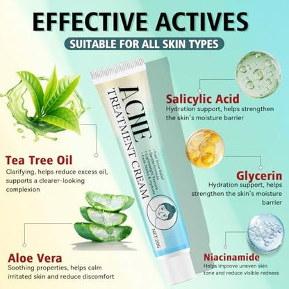 Acne Treatment Cream for Face & Body – Gentle Daily Moisturizer for Oily & Blemish-Prone Skin Avelisse