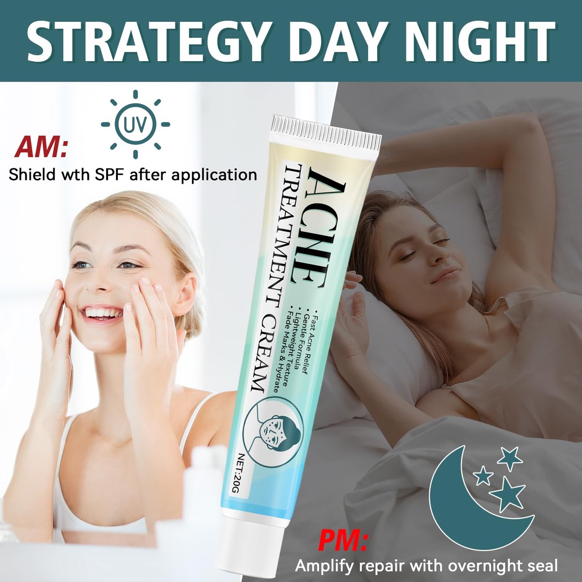 Acne Treatment Cream for Face & Body – Gentle Daily Moisturizer for Oily & Blemish-Prone Skin Avelisse