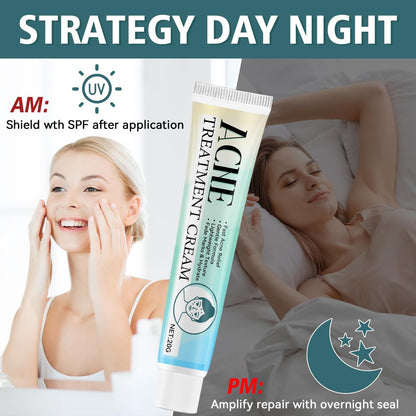 Acne Treatment Cream for Face & Body – Gentle Daily Moisturizer for Oily & Blemish-Prone Skin Avelisse