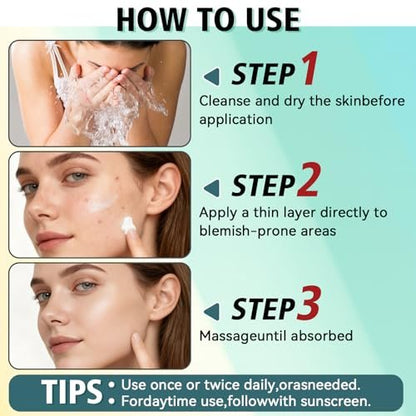 Acne Treatment Cream for Face & Body – Gentle Daily Moisturizer for Oily & Blemish-Prone Skin Avelisse