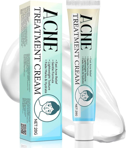 Acne Treatment Cream for Face & Body – Gentle Daily Moisturizer for Oily & Blemish-Prone Skin Avelisse
