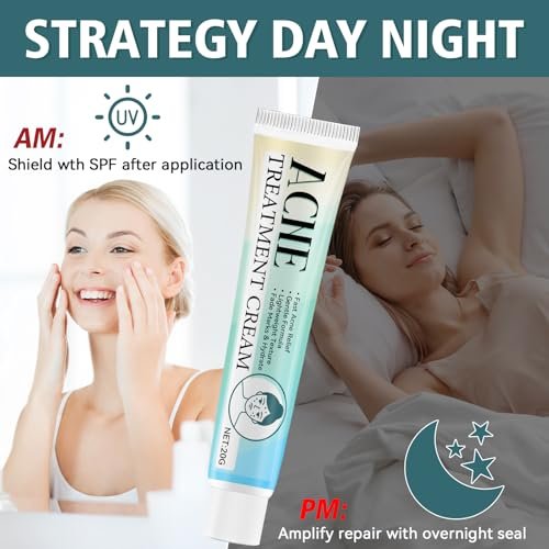 Acne Treatment Cream for Face & Body – Gentle Daily Moisturizer for Oily & Blemish-Prone Skin Avelisse