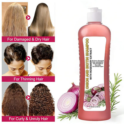 Onion Rosemary Shampoo with Biotin & Citric Acid - Nourishing Hair Care for Dry, Damaged Hair, Promotes Shine and Healthy-Looking Strands (8.39 Fl Oz)
