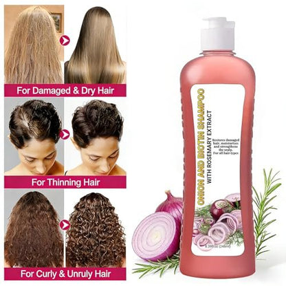 Onion Rosemary Shampoo with Biotin & Citric Acid - Nourishing Hair Care for Dry, Damaged Hair, Promotes Shine and Healthy-Looking Strands (8.39 Fl Oz)