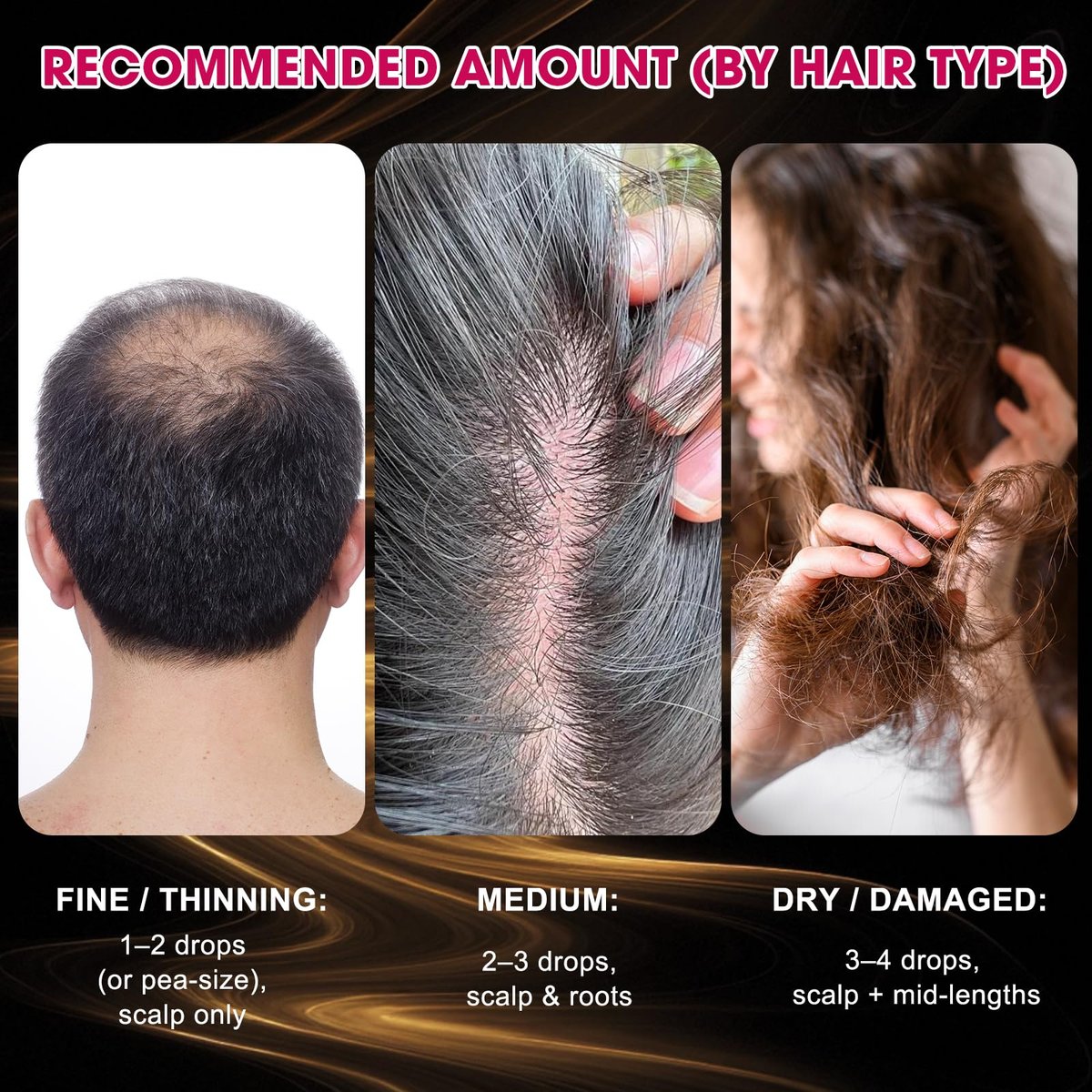 Onion Hair Growth Serum for Scalp & Hair Care - Hydrating Serum with Onion Extract, Rosemary & Biotin, Lightweight Daily Care for Fuller-Looking Hair (2.03 FL OZ) Avelisse