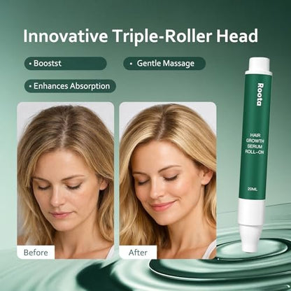 Roota Hair Growth Serum Roll-On – Revitalize Scalp for Thicker, Healthier Hair, 25ml (Pack of 2) Avelisse