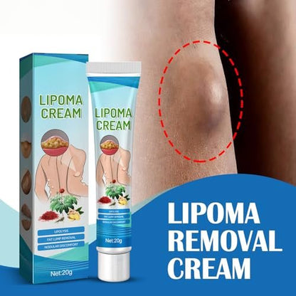 Lipoma Cream with Plant Extracts – Quick Effect Fat Lump Removal, Easy to Use, 20g/0.7oz Avelisse