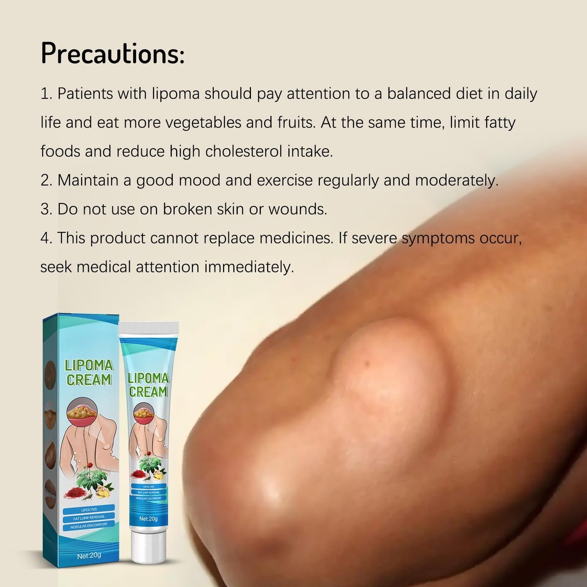 Lipoma Cream with Plant Extracts – Quick Effect Fat Lump Removal, Easy to Use, 20g/0.7oz Avelisse