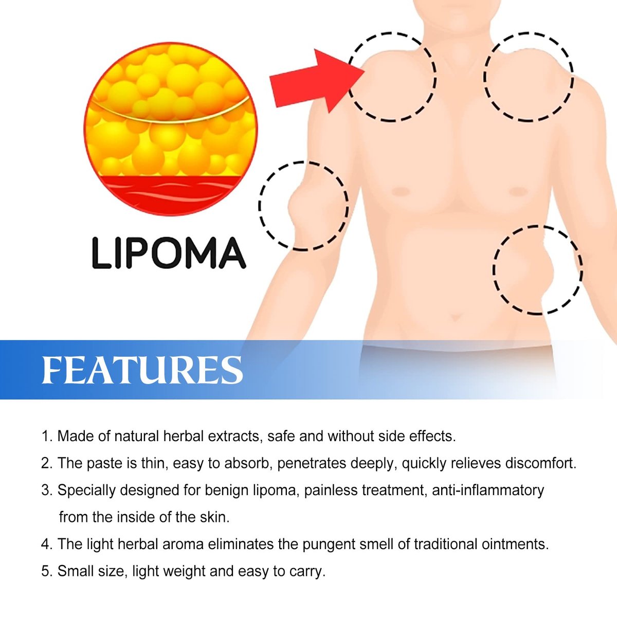 Lipoma Cream with Plant Extracts – Quick Effect Fat Lump Removal, Easy to Use, 20g/0.7oz Avelisse