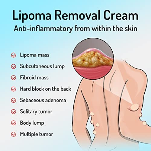 Lipoma Cream with Plant Extracts – Quick Effect Fat Lump Removal, Easy to Use, 20g/0.7oz Avelisse