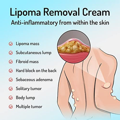Lipoma Cream with Plant Extracts – Quick Effect Fat Lump Removal, Easy to Use, 20g/0.7oz Avelisse