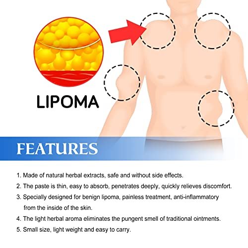 Lipoma Cream with Plant Extracts – Quick Effect Fat Lump Removal, Easy to Use, 20g/0.7oz Avelisse
