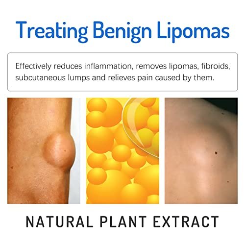 Lipoma Cream with Plant Extracts – Quick Effect Fat Lump Removal, Easy to Use, 20g/0.7oz Avelisse