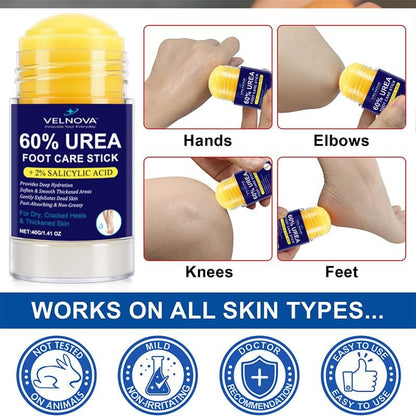 VELNOVA 60% Urea Foot Care Stick with 2% Salicylic Acid – Maximum Strength Callus Remover & Foot Cream for Dry Cracked Heels – Exfoliating Moisturizer, Non-Greasy – 1.41 oz