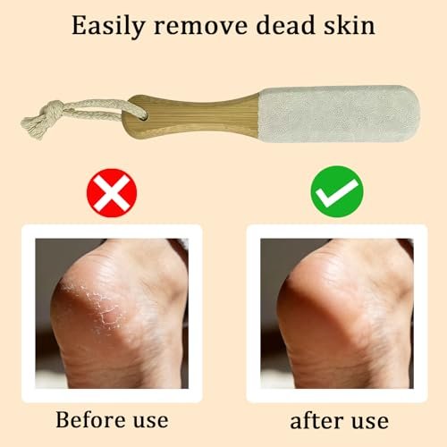 2-Pack Professional Pedicure Foot File & Pumice Stone with Wooden Handle - Callus Remover for Dead Skin, Dry Rough Feet, Cracked Heels & Corns - görsel 10