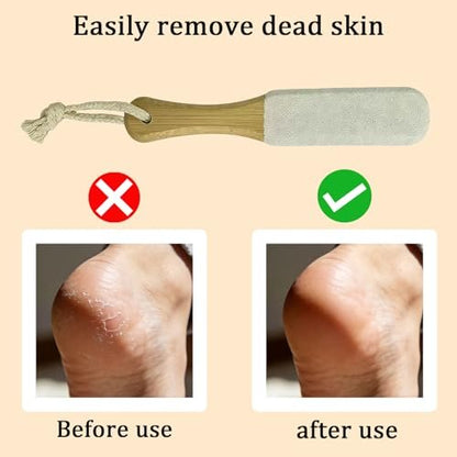 2-Pack Professional Pedicure Foot File & Pumice Stone with Wooden Handle - Callus Remover for Dead Skin, Dry Rough Feet, Cracked Heels & Corns