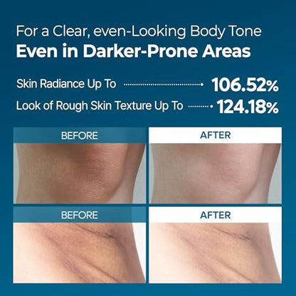 Dr.Melaxin TX Peel Shot Body Exfoliating Spray with Tranexamic Acid & Niacinamide, Brightening Body Care for Uneven Skin Tone, 200ml Avelisse