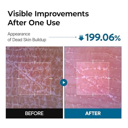 Dr.Melaxin TX Peel Shot Body Exfoliating Spray with Tranexamic Acid & Niacinamide, Brightening Body Care for Uneven Skin Tone, 200ml Avelisse
