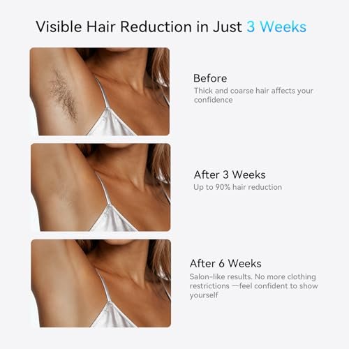 LIJAI IPL Laser Hair Removal Device for Women & Men – 999,999 Flashes Painless At-Home Hair Removal for Armpits Legs Arms Bikini Line, Silver Avelisse