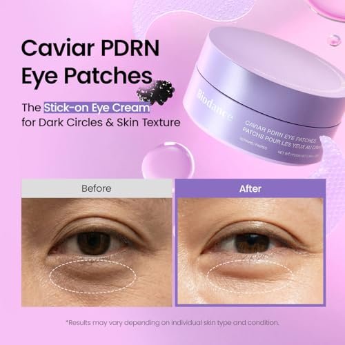 BIODANCE Caviar PDRN Eye Patches – 60 Count Nourishing Under Eye Patches for Dark Circles, Depuffing Eye Mask for Puffy & Tired Eyes, Korean Skin Care Travel Essentials & Self Care Gifts for Women Avelisse