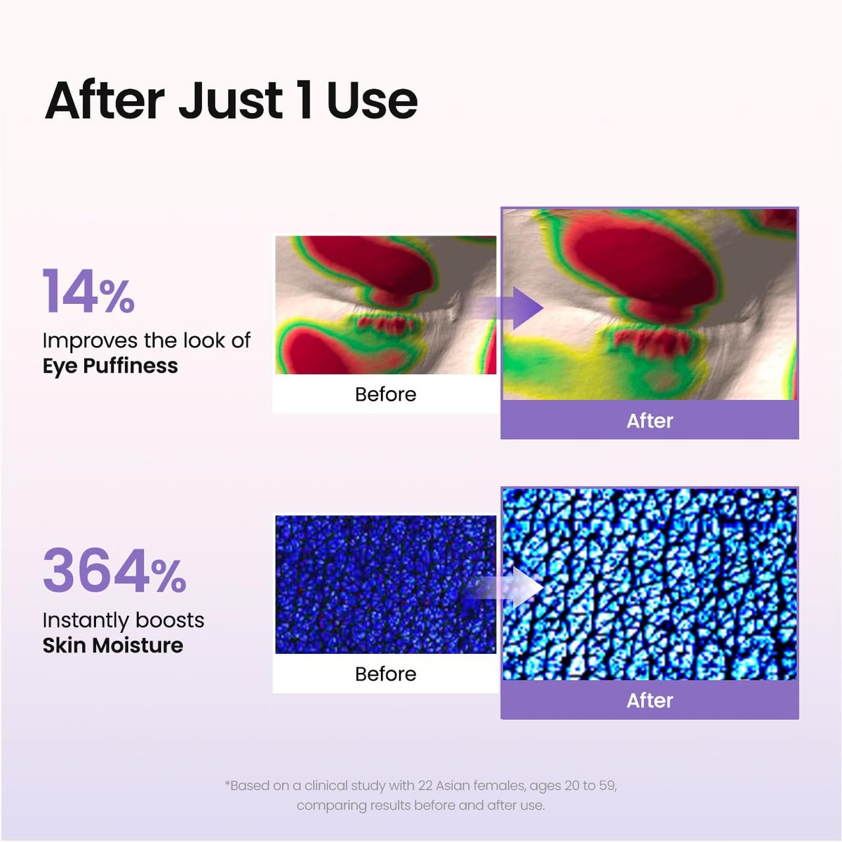 BIODANCE Caviar PDRN Eye Patches – 60 Count Nourishing Under Eye Patches for Dark Circles, Depuffing Eye Mask for Puffy & Tired Eyes, Korean Skin Care Travel Essentials & Self Care Gifts for Women Avelisse