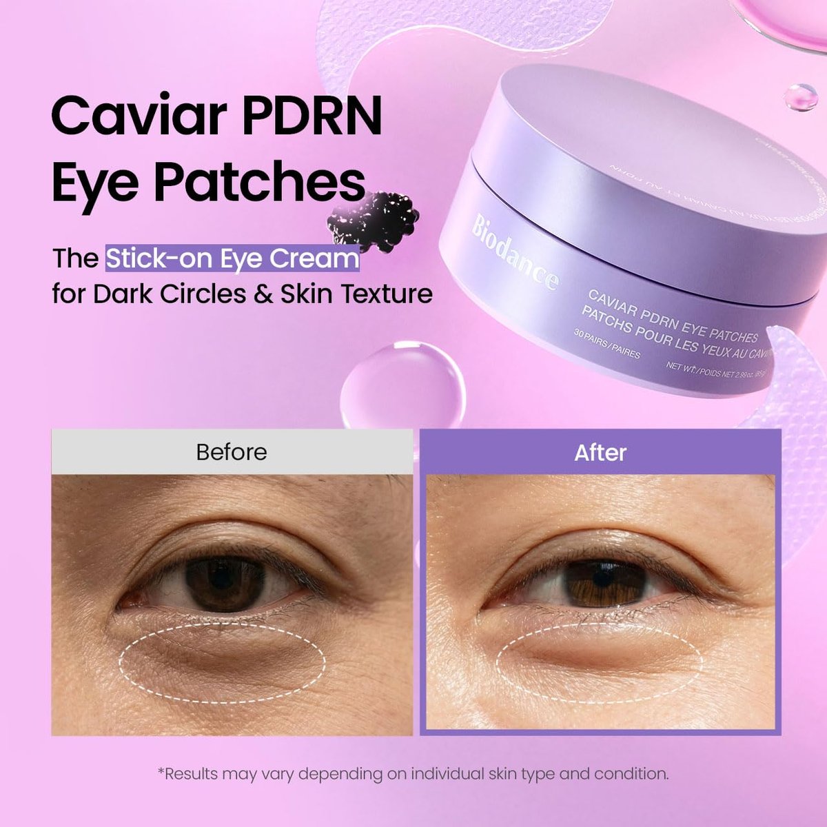 BIODANCE Caviar PDRN Eye Patches – 60 Count Nourishing Under Eye Patches for Dark Circles, Depuffing Eye Mask for Puffy & Tired Eyes, Korean Skin Care Travel Essentials & Self Care Gifts for Women Avelisse