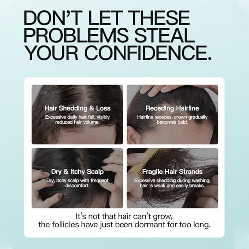 5% Minoxidil Scalp Massage Cream for Hair Growth – Extra Strength with Keratin & Ginger Root Extract for Women and Men Avelisse