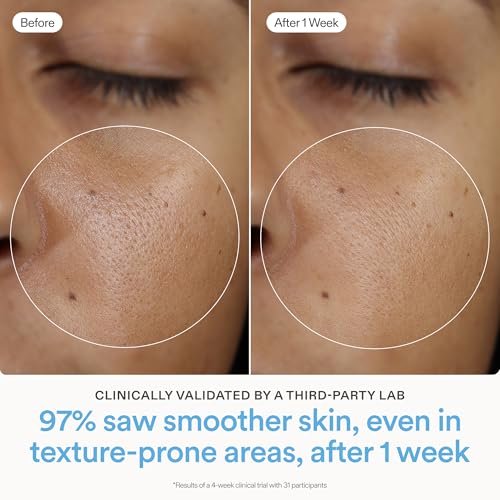 Skinfix Ceramide Prime Whipped Cream - Lightweight Face Moisturizer with Niacinamide & Peptides - 1.7 oz, Fragrance Free, Vegan & Cruelty Free Avelisse