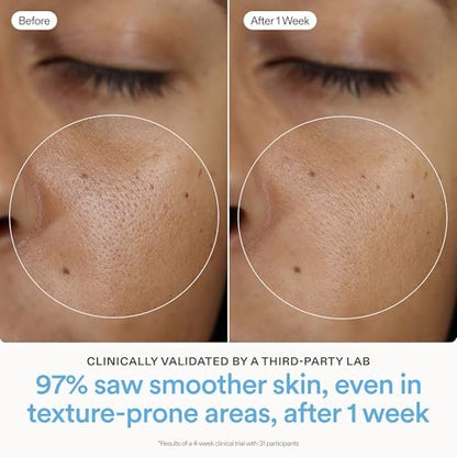 Skinfix Ceramide Prime Whipped Cream - Lightweight Face Moisturizer with Niacinamide & Peptides - 1.7 oz, Fragrance Free, Vegan & Cruelty Free Avelisse