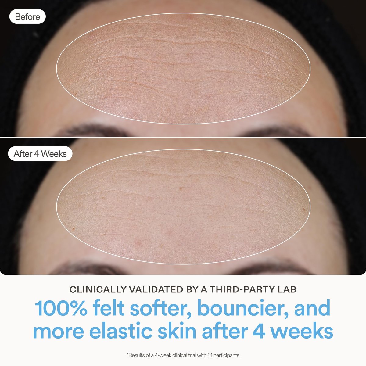 Skinfix Ceramide Prime Whipped Cream - Lightweight Face Moisturizer with Niacinamide & Peptides - 1.7 oz, Fragrance Free, Vegan & Cruelty Free Avelisse