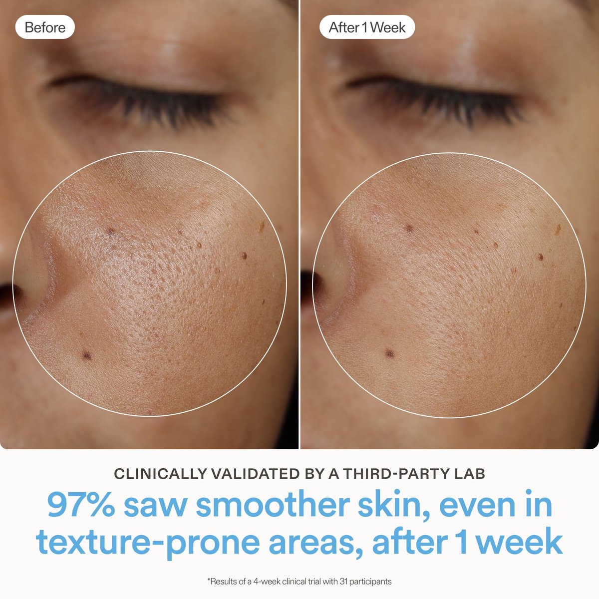 Skinfix Ceramide Prime Whipped Cream - Lightweight Face Moisturizer with Niacinamide & Peptides - 1.7 oz, Fragrance Free, Vegan & Cruelty Free Avelisse