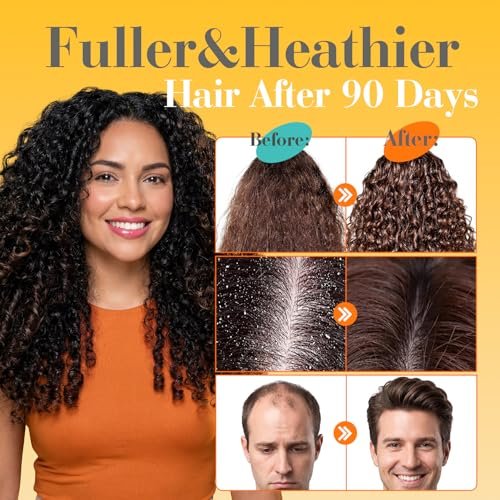 Batana Oil for Hair Growth – 100% Pure Organic Wild Growth Hair Oil from Honduras, Promotes Hair Thickness & Prevents Loss, Cold Pressed Scalp Mask for Women, 5.3 oz Avelisse