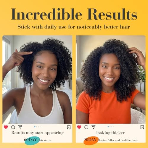 Batana Oil for Hair Growth – 100% Pure Organic Wild Growth Hair Oil from Honduras, Promotes Hair Thickness & Prevents Loss, Cold Pressed Scalp Mask for Women, 5.3 oz Avelisse