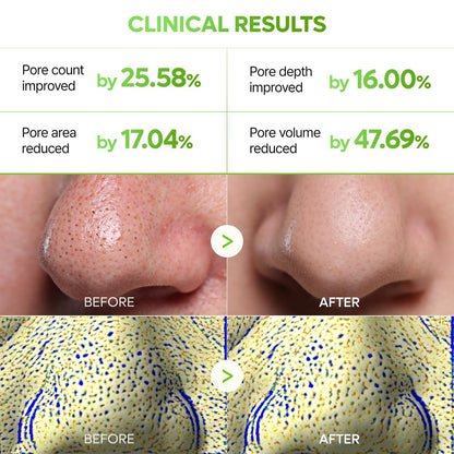 Dr.Melaxin CACTOX 3-Step Nose Mask Pack with AHA & PHA for Sebum Softening, Pore Tightening & Skin Repair - 3 Count
