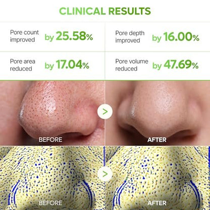 Dr.Melaxin CACTOX 3-Step Nose Mask Pack with AHA & PHA for Sebum Softening, Pore Tightening & Skin Repair - 3 Count